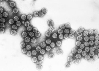 microscope image of SV40 virus particles