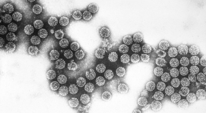 microscope image of SV40 virus particles
