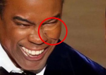 Was Chris Rock Wearing a Face Pad When Will Smith Slapped Him?