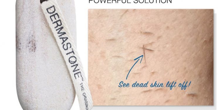 Dermastone Leg & Body Scrub Strawberry Legs Treatment