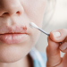 How To Get Rid Of Cold Sores